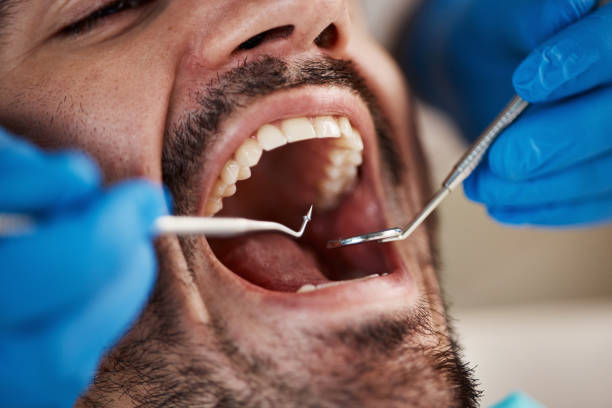 Best Knocked-Out Tooth Emergency  in Wayzata, MN
